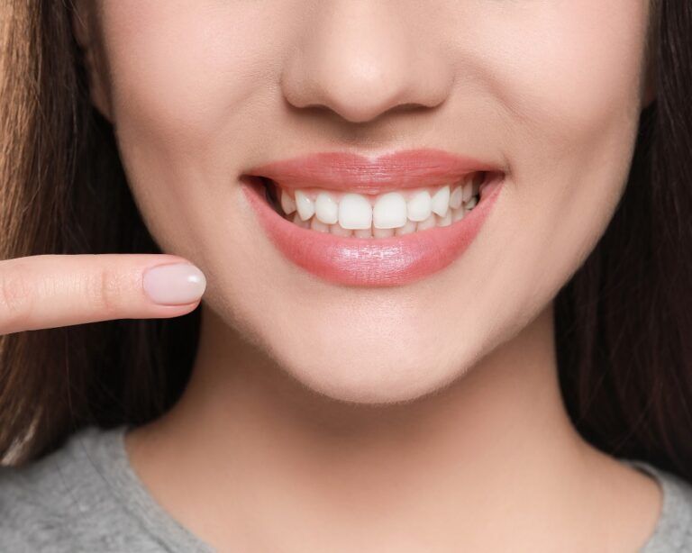 Sonrisa
